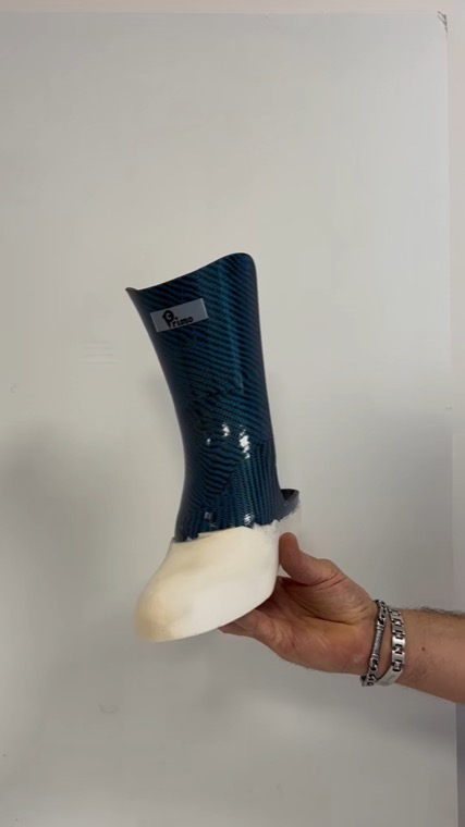 Protesi per amputazione di Lisfranc